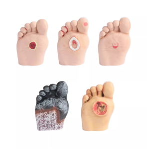 Modello didattico del piede diabetico, Modello del piede per infermieristica, Modello patologico - Product Image 5
