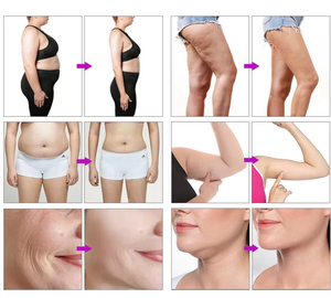 2024 <strong>Cool</strong> Rf <strong>Tech</strong> 9 Cryo Handles Cryolipolisis Body Shaping <strong>Slimming</strong> <strong>Freezing</strong> <strong>Fat</strong> Cryotherapy <strong>Slimming</strong> Weight Loss <strong>Machine</strong> - Product Image 5