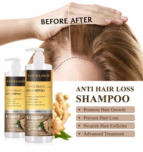 Oem Private Label Organic Regrowth Anti Dandruff Cleaning Hair Fall Preventing Anti Hair Loss Growth Ginger Shampoo Set