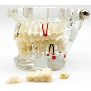 Modelo de Dientes en Oferta, Modelo de Prótesis Dental Estándar para Adultos, Modelo de Demostración para Niños - Product Image 4