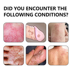 Unguento Erboristico per Prurito Cutaneo e Antipruriginoso, Crema per Tinea Cruris e Punture di Zanzara - Product Image 3