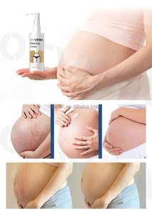 OTVENA Crème Raffermissante Haute Qualité pour le Corps, Élimine les Cicatrices de Grossesse, Traitement de l'Acné, Vergetures, Réparation et Brûle-Graisse - Product Image 2