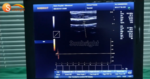 SUN-800F Appareil d'échographie 3D portable le plus vendu, instrument de diagnostic échographique PW CW pour usage humain - Product Image 4