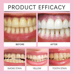 ORALHOE Produit populaire Soins bucco-dentaires Nettoyage doux des dents Poudre jaune propre haleine rafraîchissante Beauté des dents - Product Image 3