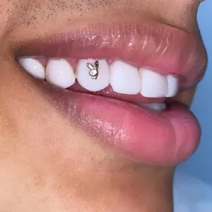 Custom Shape 10k 14k 18k 22k Mini Solid Gold Tooth Gem Dental Teeth Gems