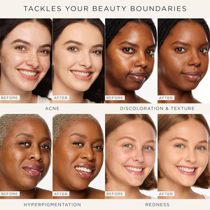 Corrector Líquido Facial de Cobertura Media a Completa, Hidratante y Corrector de Color, Marca Blanca, para Colores de Corrector <span class=keywords><strong>Tarte</strong></span> - Product Image 6