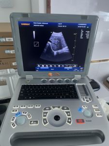 Máquina de Ultrasonido Portátil Profesional Pw Doppler USG 2D 3D al Mejor Precio - Product Image 6