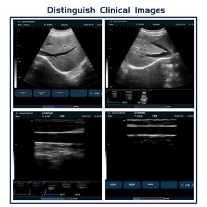 Sistem <span class=keywords><strong>Ultrasound</strong></span> Diagnostik Medis Portabel N60, Peralatan Diagnostik <span class=keywords><strong>Digital</strong></span> Penuh dengan Layar LCD 15 Inci - Product Image 3