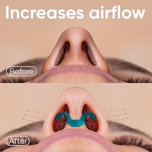 Améliorer le flux d'air Anti ronflement pince-nez dilatateur nasal bandes ouvrir votre nez respirer mieux réduire le ronflement nez évents dispositif - Product Image 2