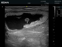 Échographe portable de diagnostic EDAN AX9 neuf et EDAN AX9 pour usage vétérinaire