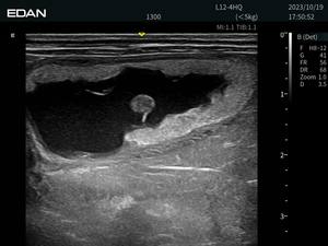 Ecógrafo Veterinario EDAN ACCLARIX AX9, Ecógrafo de Diagnóstico Portátil para Veterinarios en Venta - Product Image 4