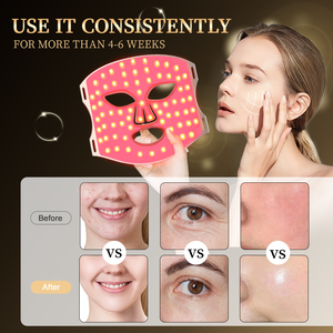 Masker silikon lembut Grade makanan Korea, produk perawatan kecantikan pribadi untuk masker wajah terapi lampu Led Set Perawatan Kulit - Product Image 3