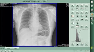 Peralatan Detektor Panel Datar Sinar-X Digital Sistem <span class=keywords><strong>DR</strong></span> Nirkabel - Product Image 2