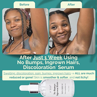 Sérum anti-poils incarnés et boutons de rasage à marque privée – Élimine les boutons de rasage, les brûlures de rasoir et les taches sombres