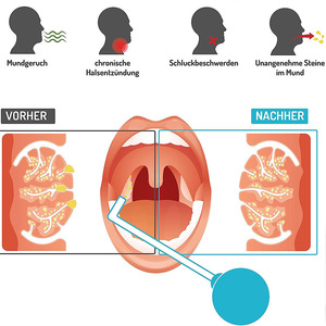 Strumento professionale per l'igiene orale multiuso pesca Body Stone dispositivo <span class=keywords><strong>di</strong></span> rimozione gola vetro tubo sottile bocca <span class=keywords><strong>di</strong></span> aspirazione - Product Image 3
