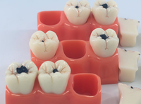 Modelo anatómico de enfermedad de caries dental con resina de aumento 3x modelo de cabeza de ciencia médica de PVC para escuelas entrenamiento de hospitales