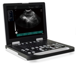 Laptop 15 Inci Berbasis Diagnostik Veteriner Digital Penuh Mode B <span class=keywords><strong>Ultrasound</strong></span> dengan Desain Pencitraan Portabel - Product Image 3