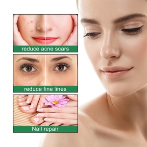 Olio di ricino Jaysuing per la cura dei capelli, idratante, anticaduta, rinforzante, per massaggio del cuoio capelluto, essenza nutriente. - Product Image 3