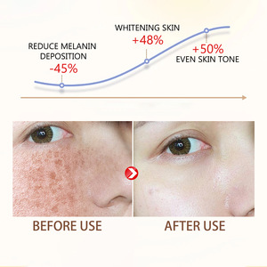 Vente en gros facile à utiliser texture légère et non collante éclaircir les taches du visage hydrater et blanchir la peau crème pour le visage - Product Image 4