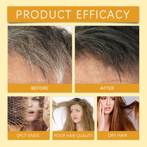 Jabón Champú de Polygonum Multiflorum 120g, Nutritivo para el Cabello y Cuero Cabelludo, Reparador, Uso Diario, para Cabello Seco y Encrespado - Product Image 4