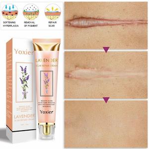 Kem trị sẹo Yoxier Lavender, 20g - Loại bỏ sẹo & vết thâm mụn, chống viêm & phục hồi da - Product Image 3