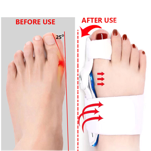 Attelle orthopédique articulée pour le soulagement de la douleur du hallux valgus avec coussinets pour le hallux valgus, protège-orteils redresseur - Product Image 4