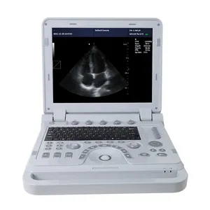 Contec Cms1700a Kleur Doppler Cardiale Echografie Scanner Draagbare Echocardiografie Machine