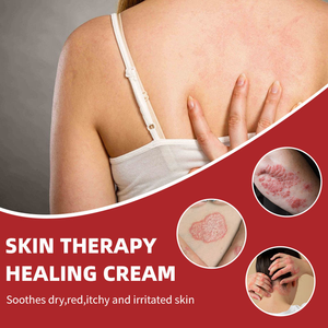 Crème anti-démangeaisons India Fungus King, puissante pommade antibactérienne à base de plantes pour les piqûres de moustiques et la chaleur épineuse. Eczéma et Psoriasis 50g - Product Image 3
