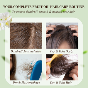 Oem ODM Sulfate miễn phí dầu gội chăm sóc tóc thiết lập thiệt hại sửa chữa nuôi dưỡng kiểm soát dầu làm mới tự nhiên chống gàu dầu gội đầu - Product Image 2