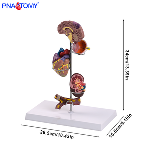 Modelo Anatómico <span class=keywords><strong>de</strong></span> 5 Partes <span class=keywords><strong>de</strong></span> los Órganos del Cerebro, Corazón, Ojo, Riñón y Vasos Sanguíneos, Producto <span class=keywords><strong>de</strong></span> Ciencia Médica para <span class=keywords><strong>el</strong></span> Estudio <span class=keywords><strong>de</strong></span> la Hipertensión - Product Image 2