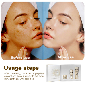 Set Viso Super Sbiancante OEM 577 377, Trattamento Riparatore <span class=keywords><strong>Anti</strong></span>-<span class=keywords><strong>Acne</strong></span>, Siero e Crema Schiarente per la Cura della Pelle - Product Image 2