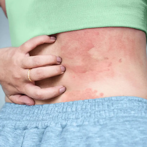 Crème anti-démangeaisons pour les mains et les pieds - Baume réparateur nourrissant et éliminant les peaux mortes - Product Image 5