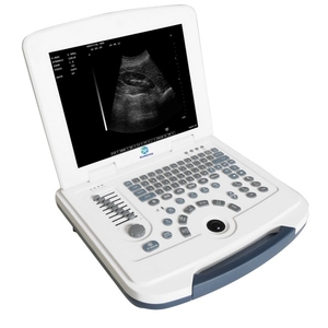 Ecógrafo Portátil Digital de 12.1 Pulgadas SRB-03 con Pantalla de Alta Resolución que Ofrece Imágenes Nítidas para Pre - Product Image 1