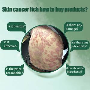 Крем для снятия псориаза для Тела облегчает зуд и устраняет покраснение - Product Image 2