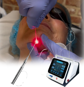 <span class=keywords><strong>Precio</strong></span> de Fábrica, Láser Endo para Rejuvenecimiento de la Piel, Lifting Facial, Endoláser para Rostro, Cánula de Liposucción, Láser de Diodo de 1470nm - Product Image 1