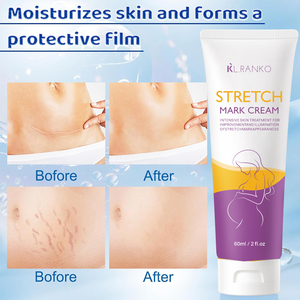 Crema <span class=keywords><strong>para</strong></span> estrías OEM con etiqueta privada, ingredientes naturales <span class=keywords><strong>para</strong></span> la reparación intensiva de la piel, suaviza <span class=keywords><strong>las</strong></span> cicatrices, suaviza <span class=keywords><strong>el</strong></span> cuidado posparto dañado - Product Image 5