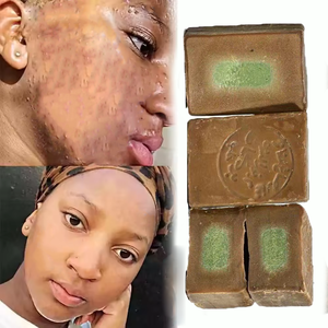 Savon artisanal naturel à l'<span class=keywords><strong>huile</strong></span> de baies de laurier et aux olives <span class=keywords><strong>pour</strong></span> peaux à problèmes <span class=keywords><strong>d</strong></span>'acné et <span class=keywords><strong>d</strong></span>'eczéma (vente en gros) - Product Image 1