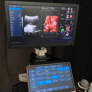 Beberapa Probe 3D 4D Digital Vet <span class=keywords><strong>ultrasound</strong></span> <span class=keywords><strong>Scan</strong></span> warna Doppler mesin <span class=keywords><strong>Ultrasound</strong></span> troli dokter hewan <span class=keywords><strong>ultrasound</strong></span> - Product Image 3