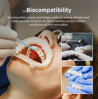 Resina Dental 3D Pionext de Ultra Alta Precisión, Impresión Rápida, Buena Resistencia a la Flexión y a la Tensión, Resina para Coronas Temporales