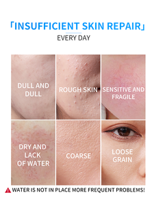 Ampolla de Oligopéptidos, Suero Natural para el Cuidado de la Piel, Líquido que Mejora la Opacidad, Hidrata la Barrera Cutánea, Calma la Piel del Rostro para Uso Privado - Product Image 4