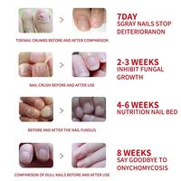 Solution réparatrice pour ongles South Moon Herbal 20ml, nettoie, blanchit, nourrit les ongles, soin antifongique pour les ongles des orteils, emballage individuel