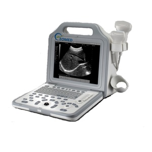 Appareil à ultrasons portable économique pour l'imagerie médicale, scanner à ultrasons, appareil vétérinaire BW21B - Product Image 3