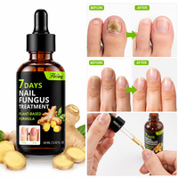 Sérum de Traitement des Ongles au Gingembre 60ml Marque Privée OEM ODM – Réparation Rapide en 7 Jours pour Ongles Jaunes, Épais, Cassants et Soin Antifongique des Ongles des Pieds