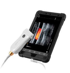 Doppler de couleurs Intelligent de mm, B/W, application de contrôle des ultrasons portables POC - Product Image 2