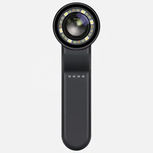 IBOOLO DE-4100 Dermatoscopio médico de mano Base de instrumentos quirúrgicos Dispositivo de ayuda visual para dermatoscopia - Product Image 1