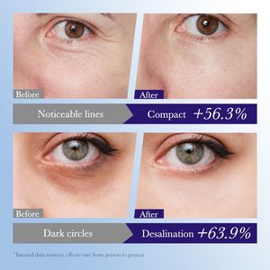 Crème contour des yeux nourrissante, raffermissante et hydratante à bas <span class=keywords><strong>prix</strong></span>, primevère, crème pour les yeux à la vitamine E en gros - Product Image 4