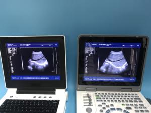 Hewan portabel murah menggunakan <span class=keywords><strong>ultrasound</strong></span> anjing kehamilan <span class=keywords><strong>ultrasound</strong></span> <span class=keywords><strong>laptop</strong></span> dokter hewan - Product Image 4