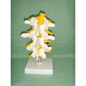 Modèle de colonne lombaire normale combiné ; Modèle de colonne lombaire en 3 sections ; Modèle de colonne lombaire en 3 sections ; Modèle de colonne lombaire en 4 sections - Product Image 3
