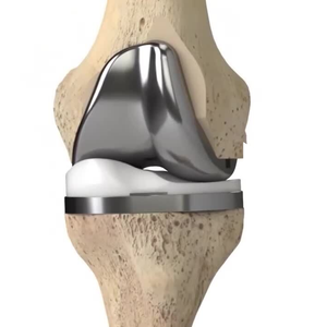 Prótesis de Rodilla Posteriormente Estabilizada, Implante de Reemplazo de Articulación Ortopédica, Prótesis de Rodilla PS - Product Image 1