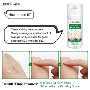 ETRUN ALISA Marque privée <span class=keywords><strong>Gel</strong></span> en <span class=keywords><strong>silicone</strong></span> pour enlever les cicatrices anciennes et nouvelles cicatrices d'acné <span class=keywords><strong>Gel</strong></span> topique lisse pour éliminer l'acné pour les soins de la peau - Product Image 4